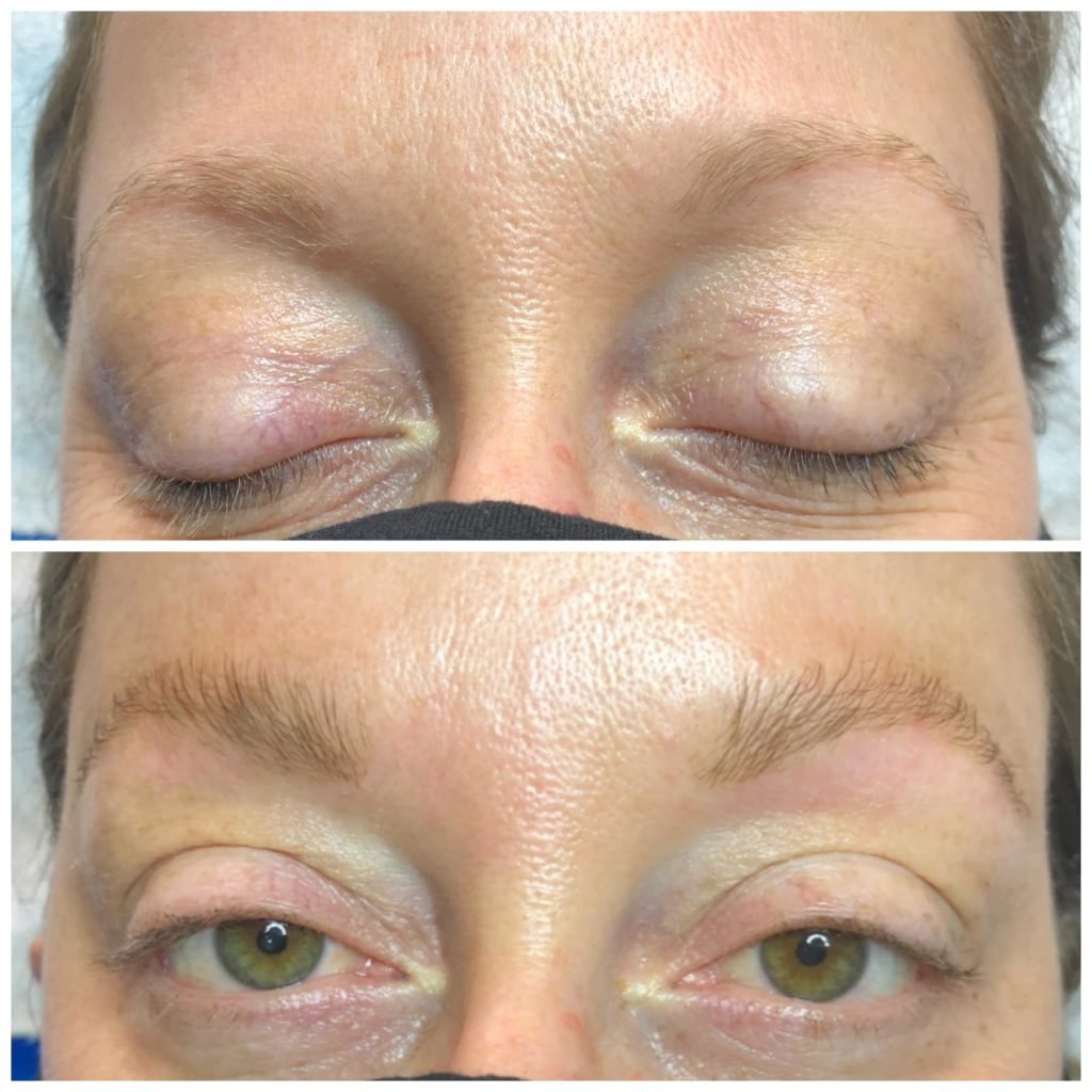 before and after eyebrow tint